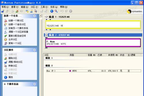 ϵy֮ҽwindowsϵyʹpqօ^ħg